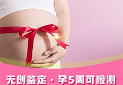贵阳如何做产前亲子鉴定(挂号预约)